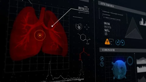 Analysis for coronavirus. Lung test. Different frame sizes. Stock Footage 127036933