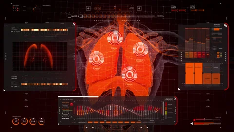 Analysis of Human Anatomy. Blood circulation, x-ray scan of lungs. DNA Stock Footage 145125066