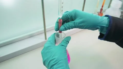 Analysis in the laboratory. Clip. Chemical testing through mixing Stock Footage 166469462