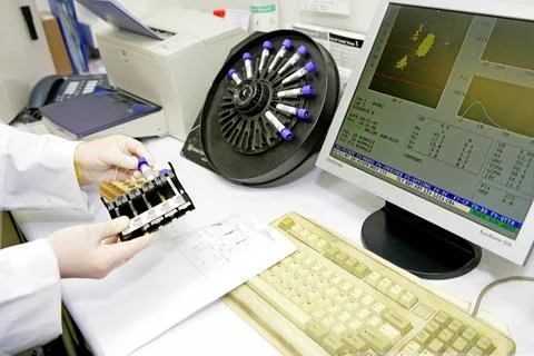  Analysis laboratory Laboratory. Test tubes holder of the hematology autom... Foto stock