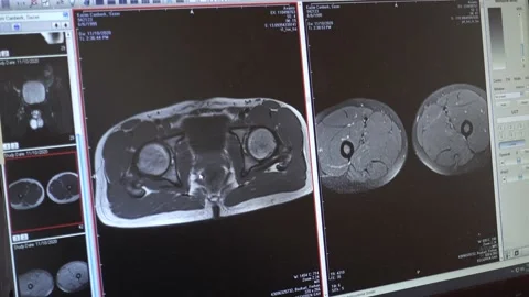 Analysis of a patient's Magnetic Resonance Imagining results Stock Footage 143771402