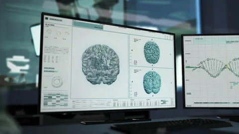 Analysis Of Skull Image Projected On Screen In Modern Hospital Laboratory Stock Footage 158298988