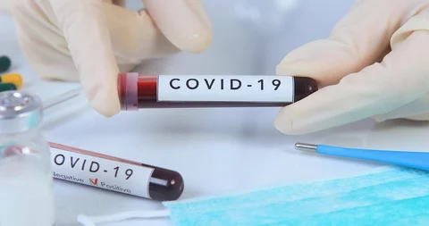 Analyst hands holding COVID 19 Coronavirus test blood Stock Footage 126770980