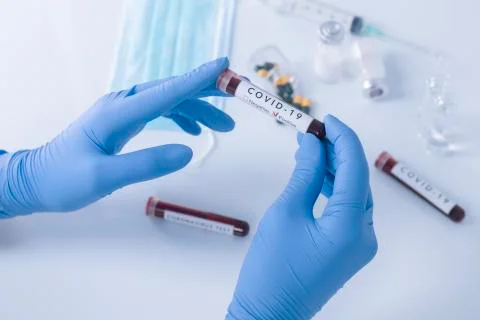 Analyst hands with protective gloves holding COVID 19 Coronavirus test blood 库存照片