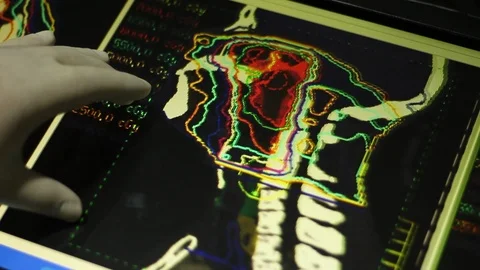 Analyze of Brain and Neck on Touch Screen Display.Doctor and MRI Scan. Stock Footage 100598982