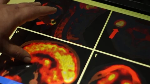 Analyze of Brain and Neck on Touch Screen Display. Doctor and MRI Scan. Stock Footage 100599437