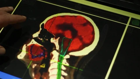 Analyze of Brain and Neck on Touch Screen Display.Doctor and MRI Scan. Stock Footage 100599541