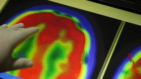 Analyzing of Brain Image on Touch Screen Display. Doctor and MRI Scan. 스톡 동영상 100598973