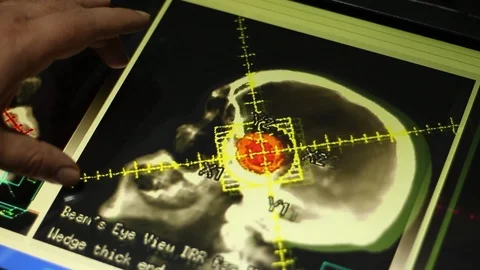 Analyzing of Brain Image on Touch Screen Display. Doctor and MRI Scan. Stock Footage 100599484