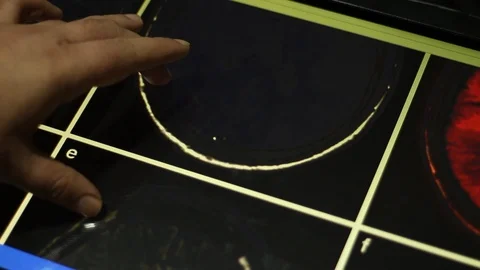 Analyzing of Brain Image on Touch Screen Display. Doctor and MRI Scan. Stock Footage 100599540
