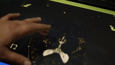 Analyzing of Brain Image on Touch Screen Display. Doctor and MRI Scan. Video stock 100599604