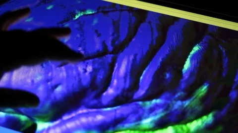 Analyzing of Brain Image on Touch Screen Display. Doctor and MRI Scan. Stock Footage 100600099