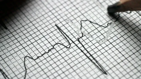 Analyzing electrocardiogram Stock-Footage 36472539