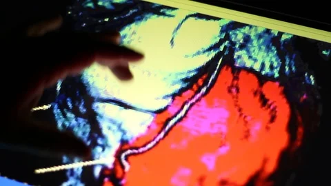 Analyzing of Heart Image on Touch Screen Display. Doctor and MRI Scan. Stock Footage 100600120
