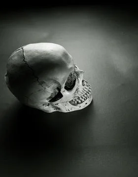 Analyzing of a human skull Stockfoto's