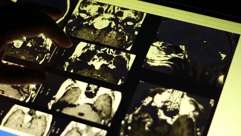 Analyzing of Spinal cord image on touch screen display. Doctor and MRI Scan. Stock Footage 100599795