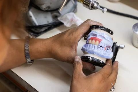 Analyzing the work with the prosthetic Stock Photos