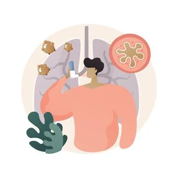 Anaphylaxis abstract concept vector illustration. Stock Illustration