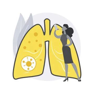 Anaphylaxis abstract concept vector illustration. Stock Illustration