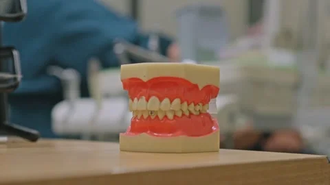 Anatomical teeth and gums educational model displayed in medical dentistry Stock Footage 337713014