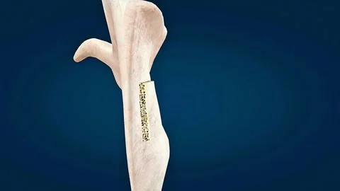 Anatomy and section of flat bone Stock Footage 320730696