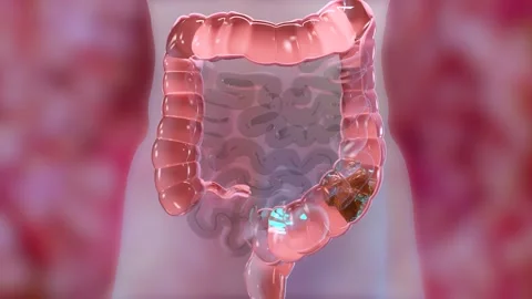 Anatomy of the human digestive system,laxative, traitement of constipation Stock Footage 190464640