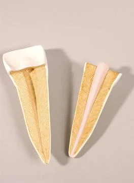  Anatomy, tooth Anatomic model of an human upper incisor (frontal section ... Stock Photos