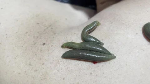 Ancient Healing Practice: Medicinal Leeches for Holistic Wellness 스톡 동영상 243283055
