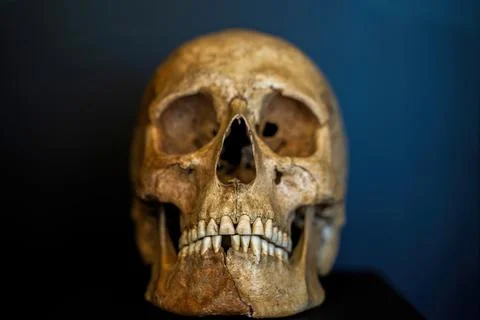 Ancient Human Skull On Dark Background For Forensic Study, Museum Display, .. Stock Photos