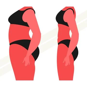 Before-and-after-body Illustrazione stock