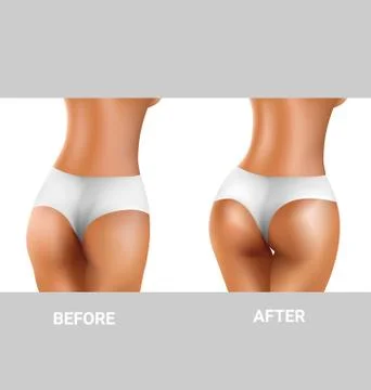 Before and after buttocks exercise Stock Illustration