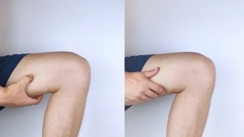 Before and after. On the left, a man has acute pain in the hip after a muscle st Stock Footage 161141426