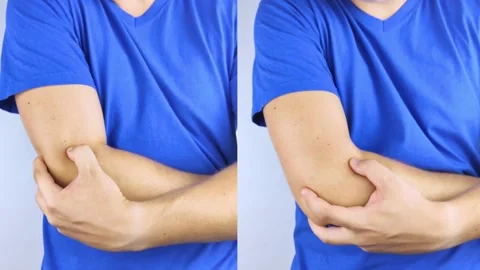 Before and after. On left man is holding onto his injured elbow. On right the do Stock Footage 161141463