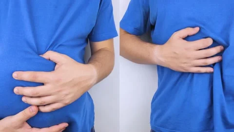 Before and after. In one half of the video, the man clasped his swollen belly, a Stock Footage 141017809