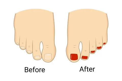 Before and after pedicure vector illustration design. Stock Illustration