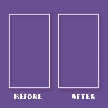 Before and After. Template background. Vector illustration. Stock Illustration