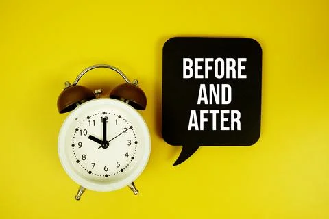 Before And After text on speech bubble with alarm clock top view on yellow .. Stock Photos