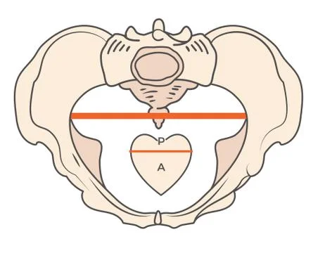 Android Pelvis Shape with Triangular or Heart shape Stock Illustration