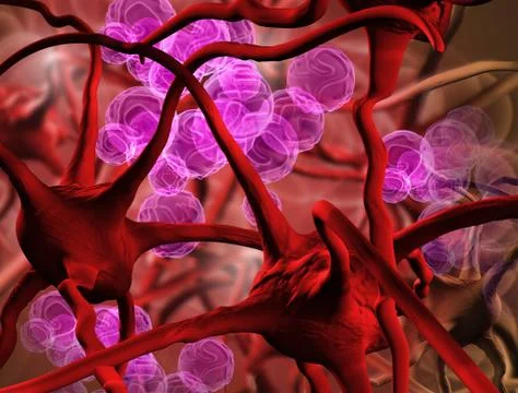 Anemia Stock Illustration