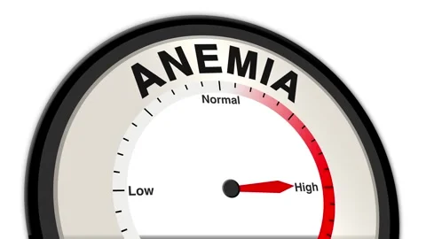 Anemia Text or Word Level Low Normal High - Barometer or Tachometer Concept Stock Footage 308345478