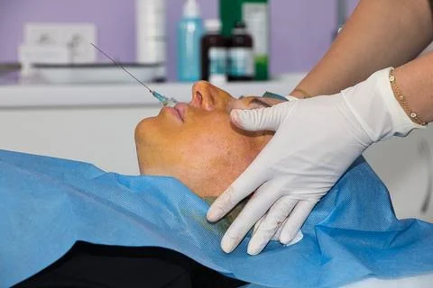 Anesthesia administered before a facelift using absorbable threads. Stock Photos