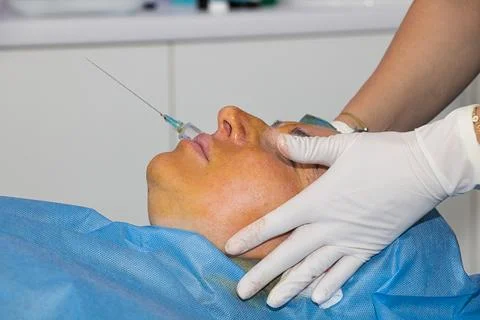 Anesthesia administered before a facelift using absorbable threads. Stock Photos