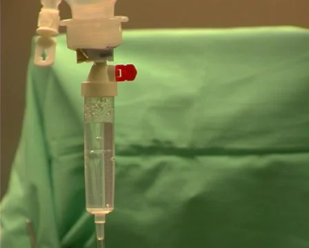 Anesthesia drops 스톡 동영상 69634