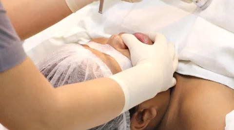 Anesthesia Video stock 8686399