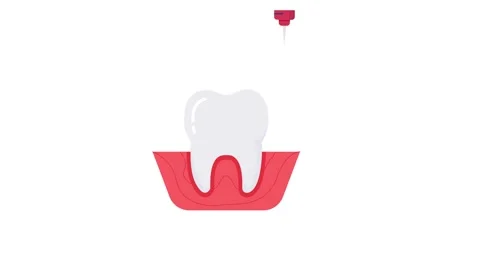 Anesthesia icon animation for video motion graphics Video stock 201304383