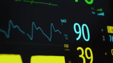 Anesthesia machine measuring oxygen saturation. Close up Stock Footage 324882693