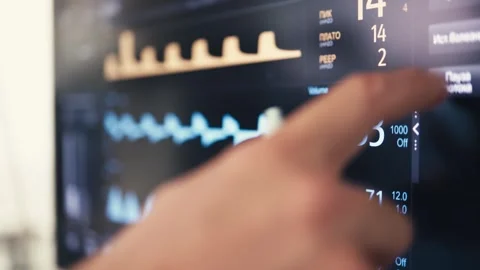 Anesthesia ventilator screen showing respiratory pressure Stock Footage 341826931