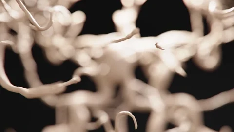 Aneurysm Visualization Video | Aneurysm and Brain topics video | Aneurysm Stock Footage 334352655