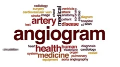 Angiogram animated word cloud, text desi... | Stock Video | Pond5