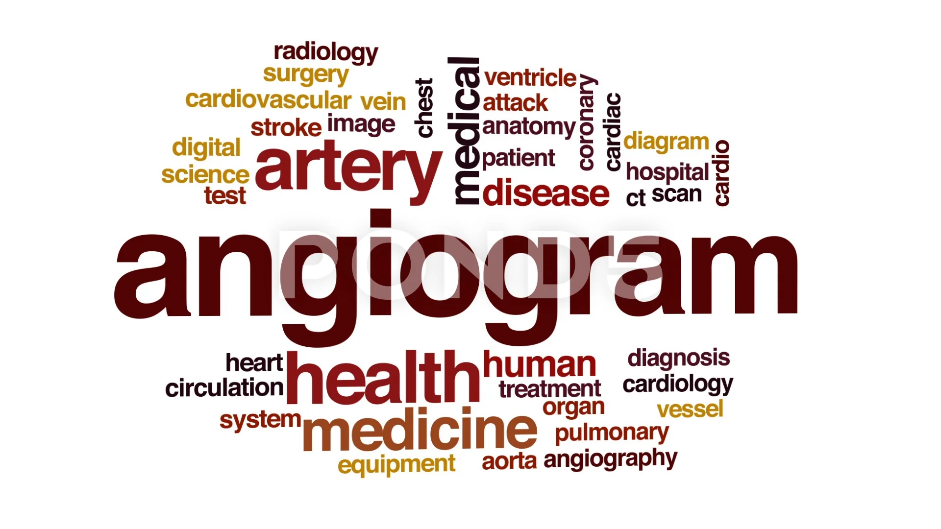 Angiogram animated word cloud, text desi... | Stock Video | Pond5